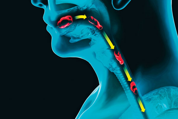 Understanding Swallowing Disorders: A Deep Dive with Dr. Karen Slonski